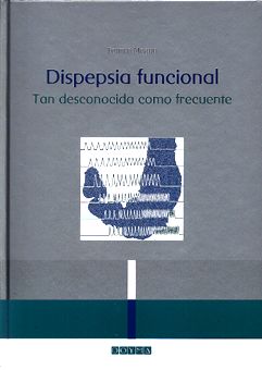 DISPEPSIA FUNCIONAL TAN DESCONOCIDA COMO FRECUENTE